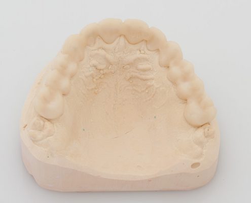 Bisshebungsschiene
