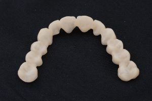 Bisshebungsschiene