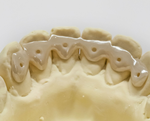 Retainer